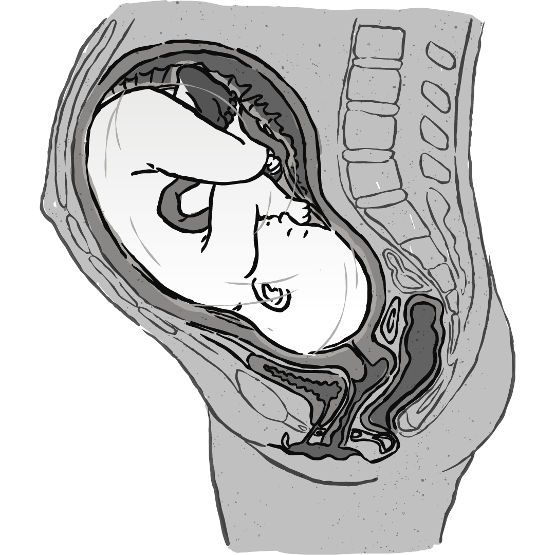 Illustration of a fetus in utero.
